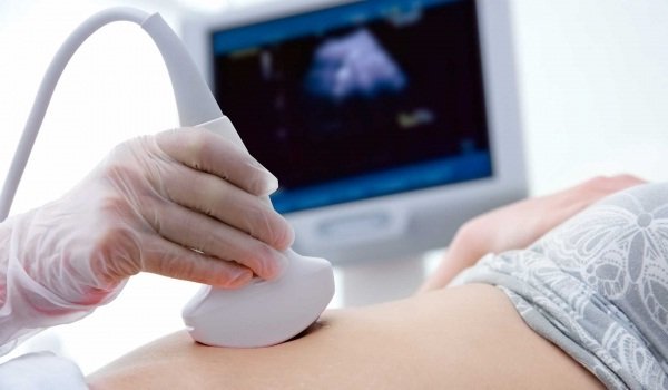 Ultrasound Machine.